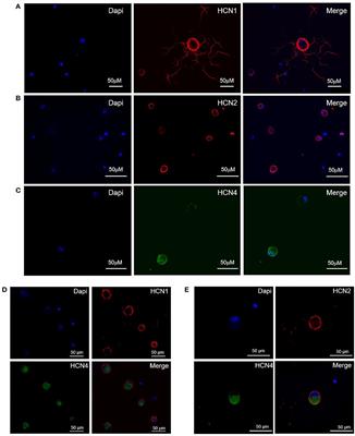 Selective Blockade of HCN1/HCN2 Channels as a Potential Pharmacological Strategy Against Pain